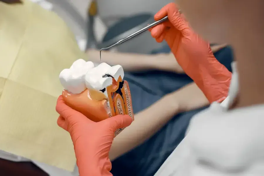 Model of a tooth being prepared for a crown