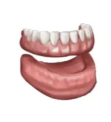 Illustration of a full denture