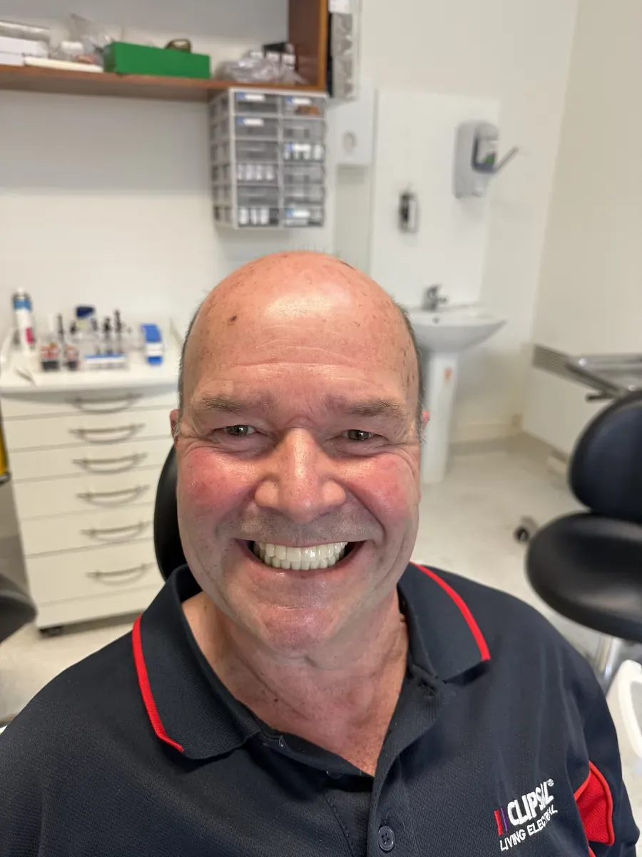 Patient smiling with new full-arch teeth