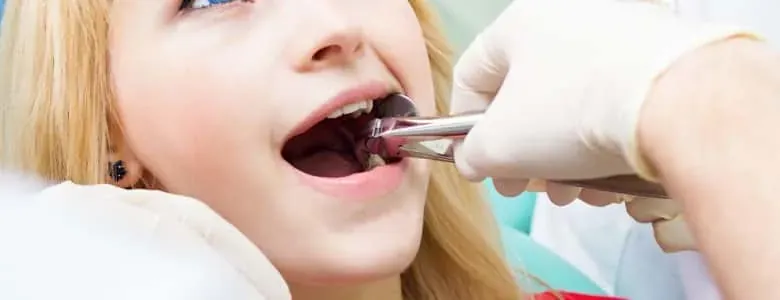 Wisdom tooth assessment